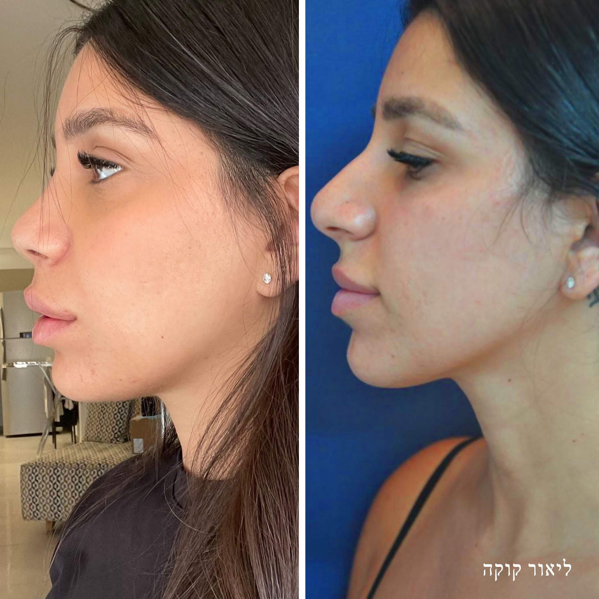 קרדיט: בוסט מדיה